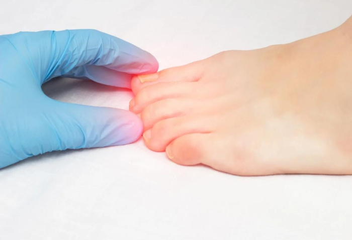 Unhas exigem cuidados especiais no inverno