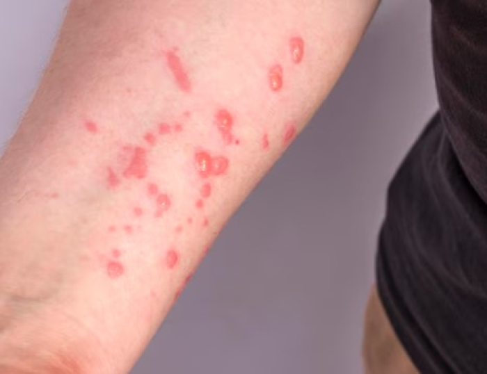 Editorial – Alerta ligado