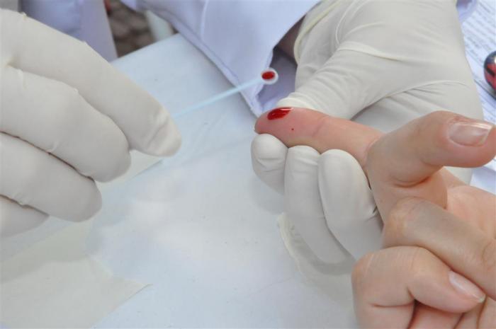 Mauá oferecerá diagnósticos gratuitos para exames de HIV, sífilis e hepatites