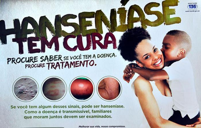 Ribeirão Pires reforça ações de combate à hanseníase