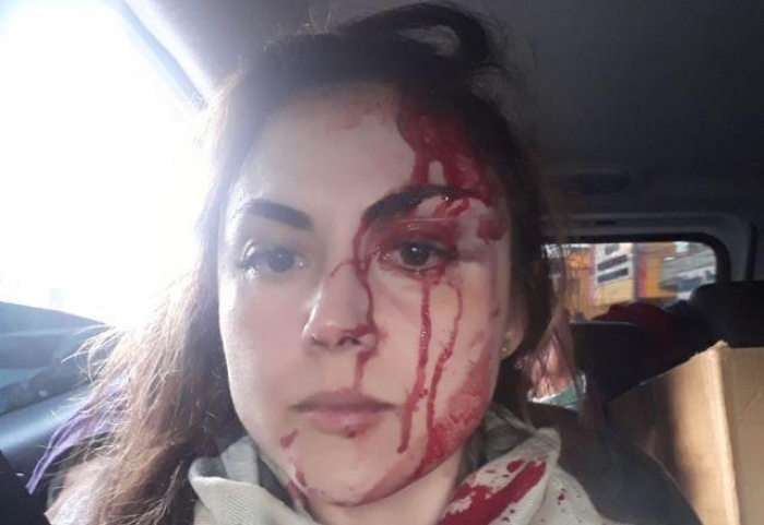 Editorial - Chega de violência