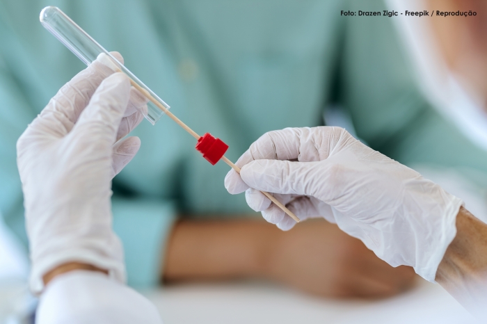 Estudo mostra que Covid-19 pode ser detectado em lágrimas com uso de swab